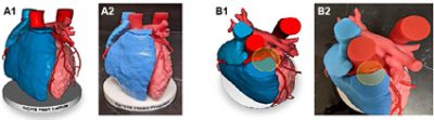 3D Printed Heart Model | 
