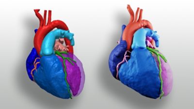 3D Printed Heart Scan | °ϲʿ