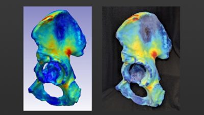 3D Printed Hip Scan | 