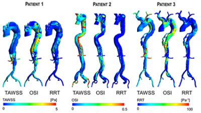 Hemodynamic indices obtained for 3 patients