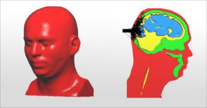 Biomedical Optics