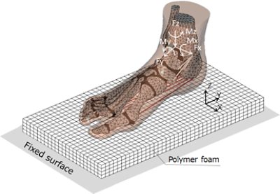 ASICS use 3D computational models to better understand the role of stability in running shoes. Optimizing with simulation reduces the risk of lower extremity injuries for runners, as well as enhancing performance. Sole structure and heel eversion angle are particularly important for understanding stability. Alongside experimental methods, models created in Simpleware software for export to Abaqus simulation tools help ASICS reduce prototyping time and costs, as well as manufacturing waste.