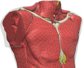 MicroPort develop lifesaving medical products for patients around the world. One of MicroPort’s specialties is in manufacturing cardiac rhythm management devices (CRM) for treating cardiac rhythm disorders and heart failures. The company use Synopsys Simpleware software to model complex pacemaker geometries to better understand patient therapies for conditions such as bradycardia and tachycardia. 
MicroPort typically use animal testing for their devices, but this is expensive, time-consuming, and has significant ethical risks when trying to reduce errors. Image-based finite element (FE) simulation offers an alternative testing method that reduces reliance on animal testing, cuts the risk of device failure, and provides insights without the same ethical hazards as animal testing.
