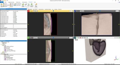 MRI slices | Simpleware ScanIP 