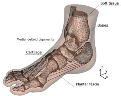 3D numerical foot model