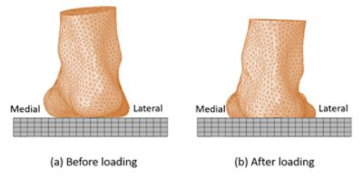 Heel eversion model