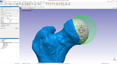 3 D Editing tools in Simpleware ScanIP offer intuitive ways to segment data 