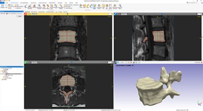  3D Wrap in Simpleware ScanIP allows you to build masks from cross sections 