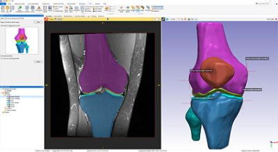 3D画像処理 | Synopsys