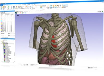 Simpleware FE provides industry-leading software tools for converting image data to Finite Element (FE) and Computational Fluid Dynamics (CFD) models for simulations. The module offers the broadest range of image-based meshing tools and most robust meshing algorithms, with extensive options for tailoring your models to different simulation requirements. Rely on meshing software that generates simulation-ready models, with no need for postprocessing or fixing. Export directly to all major FE/CFD solver formats.