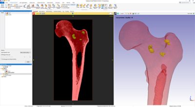 3 D Editing tools Use the Fill Gaps tool in Simpleware ScanIP to close up cavities inside objects 