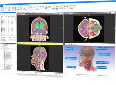 <p>ScanIP provides a comprehensive segmentation software environment for processing 3D image data (MRI, CT, micro-CT, FIB-SEM…). The software offers powerful image visualization, analysis, segmentation, and quantification tools. ScanIP exports to CAD and 3D printing, with additional modules available for FE meshing, CAD and image data integration, NURBS export, and calculating effective material properties.</p>
