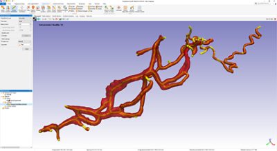 Sweep centerlines to create a minimum vessel diameter