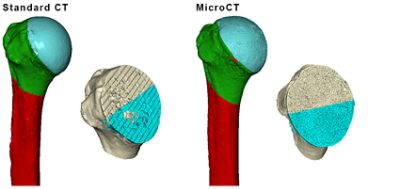 Segmentation of clinical CT and ?CT scans using °ϲʿ Simpleware