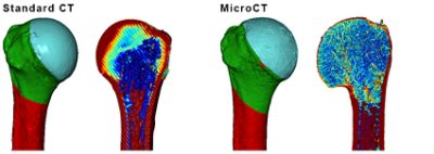 Segmentation and density measurements of clinical CT and µCT scans using Synopsys Simpleware