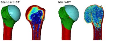 Segmentation and density measurements of clinical CT and µCT scans using Synopsys Simpleware