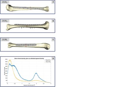 Computational models of tibiae segmented in Simpleware software (CC BY 4.0)