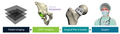 Segmentation of aortic dissection | Synopsys