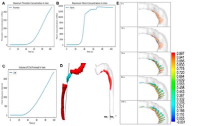 Analysis of clot formed in a vein (CC BY 4.0)