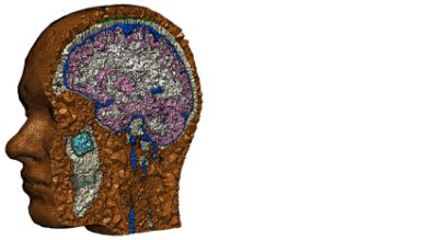 Multi-part volume mesh of the human head using the Simpleware FE module