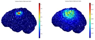 Simulation of electric field distribution during ECS in COMSOL Multiphysics©