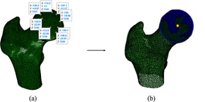 Determination of HJC using best fit sphere on the femoral head (CC BY 4.0)