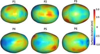 Surface deviation for head reshaping using Simpleware software (CC BY 4.0)