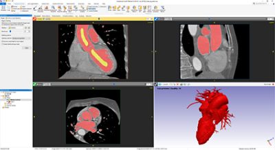 Split tool in Simpleware ScanIP for separating connected regions of the image data