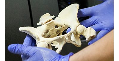 Simpleware Adds HP Printers for Use with FDA 510(k)-Cleared 3D Medical Printing Solution