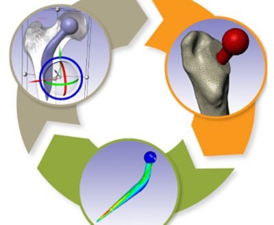 Implant positioning represents a significant challenge for total hip replacements. Implants need to be well-fitted and positioned within the medullary canal, and should ideally maximize the femoral bone-implant contact area. Experimental testing of implant positions is limited by cost. An alternative is to use computational modelling to comprehensively analyse implant position at an early stage of product development. While this approach is not intended to replace experiments, it can help surgeons to better understand the effect of implant position on primary or secondary stability.

Simpleware software and ANSYS were combined to create an automated workflow to integrate a CAD-designed implant into a CT scan of a femur, generating Finite Element (FE) models for micromotion analysis. Simulation results were used to generate response surfaces, demonstrating the effect a change in position can have on micromotion.