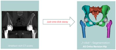 Simpleware auto segmentation tools detect anatomy in just one click