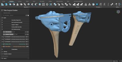 Surgical guides in nTopology software