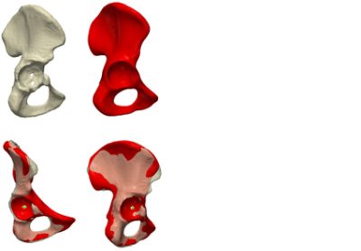 Statistical shape modelling of the hemipelvis (CC BY 4.0)