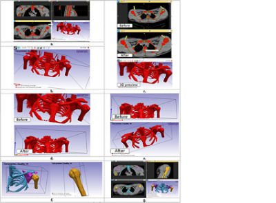 Bone segmentation process in Simpleware software (CC BY 4.0)