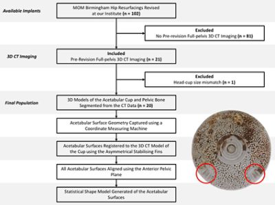 Study design and workflow of acetabular wear in retrieved hip implant (CC BY 4.0)