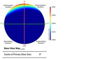 Mean acetabular surface generated through a PCA of the entire population (CC BY 4.0)