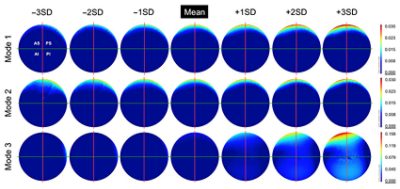 Change in geometry from ?3SD to +3SD presented as deviation maps (CC BY 4.0)