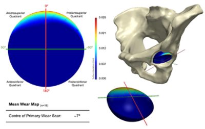 Mean acetabular surface generated through a PCA of the population (CC BY 4.0)