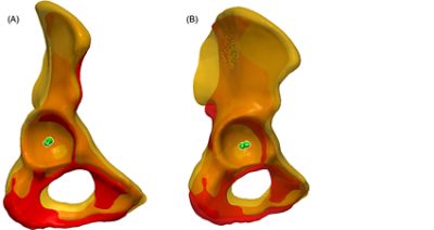 Difference in CoR between the SSM and the healthy side (CC BY 4.0)