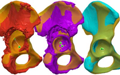 Statistical shape models (SSMs) of pelvises (CC BY 4.0)