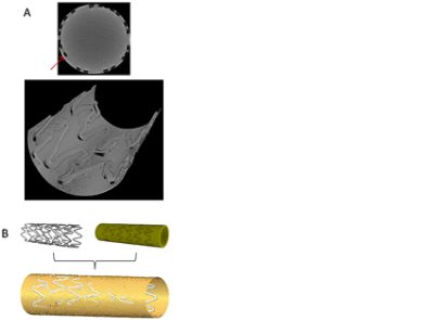Reconstructed μCT data of a stent cast and registration (CC BY 4.0)