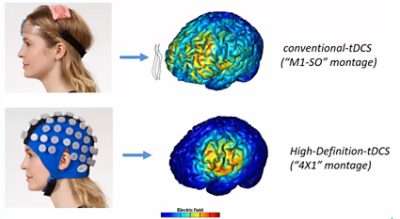 Current flow models comparing conventional-tDCS and Soterix Medical’s High-Definition-tDCS