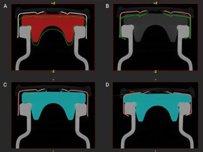 Visualization in Simpleware software how a vial stopper deforms during the sealing process