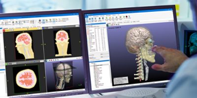 Simpleware 3D image processing and modeling software is your high-end solution for life sciences research. Intuitive tools and filters allow you to accurately visualize, analyze, and quantify your DICOM images. Export high-quality models every time from even the most complex datasets for 3D printing, design and simulation.