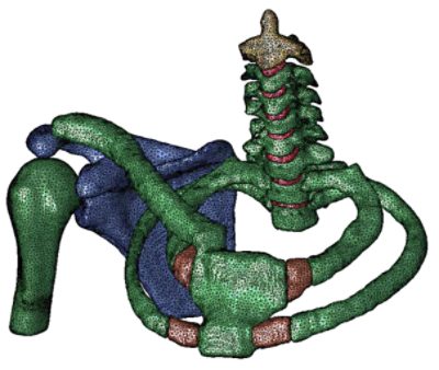 Yamaguchi University in Japan use Simpleware as part of their biomechanics research and studies of spinal injuries. 3D modeling and simulation enables detailed analysis of potential clinical solutions. In this study, adult brachial plexus injuries are examined using a complex 3D Finite Element model (FEM) of the spine, dura mater, roots, and the brachial plexus. The authors looked at the mechanism of injury for the brachial plexus, particularly for stress and strain distribution, and how useful the model is for other applications.