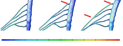 Simulation of lateroflexion of the spine